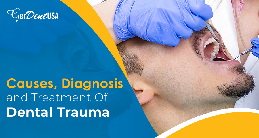 Causes, Diagnosis, and Treatment of Dental Trauma